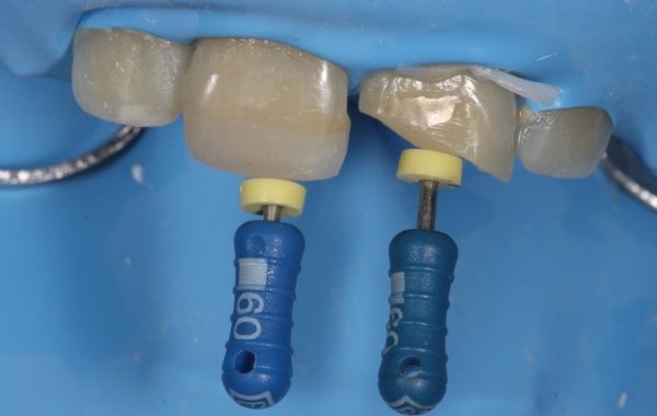 5. Intensivo endodoncia
